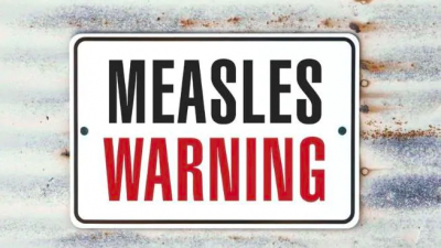 Measels outbreak in Auckland